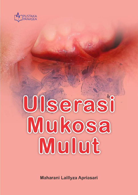Sampul buku Ulserasi Mukosa Mulu...